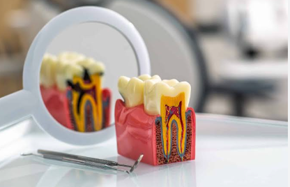 odontólogo revisando un empaste antiguo durante una exploración dental